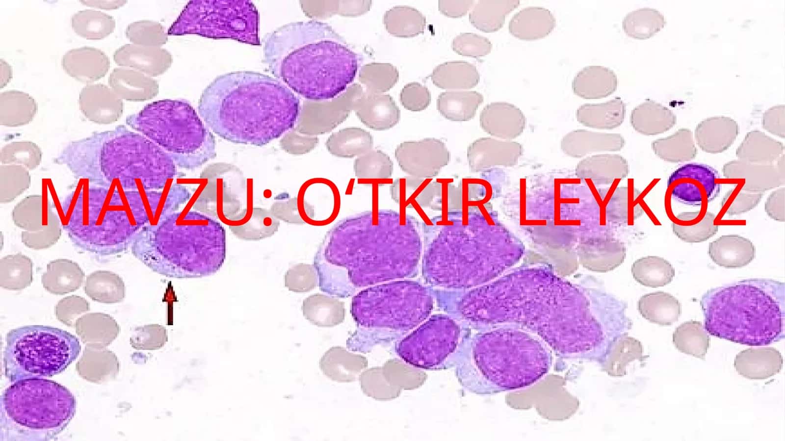 O‘TKIR LEYKOZ