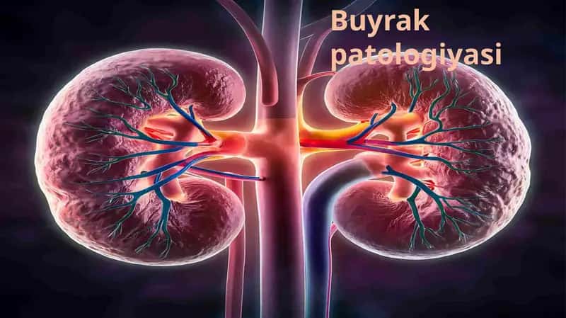 buyrak patalogiyasi
