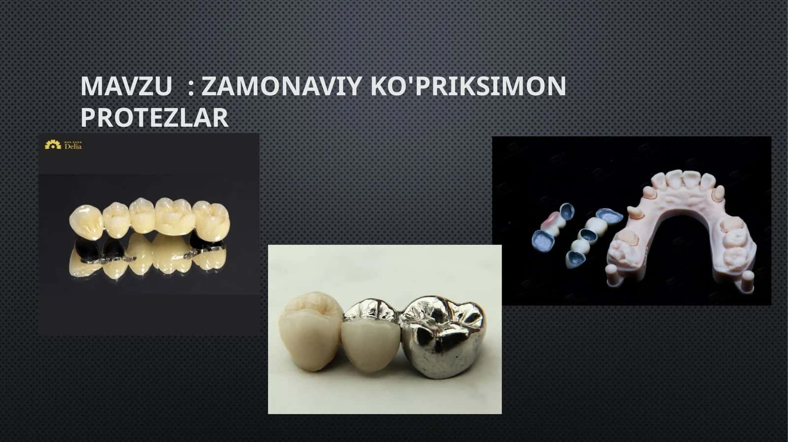 Zamonaviy Ko'priksimon protezlar