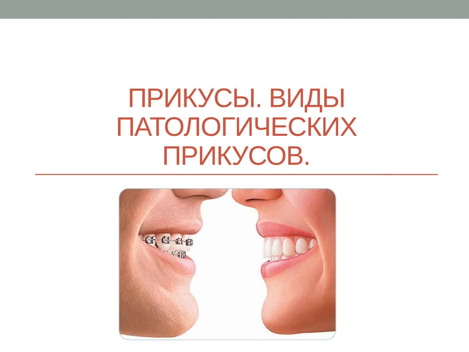 Прикусы. Виды патологических прикусов