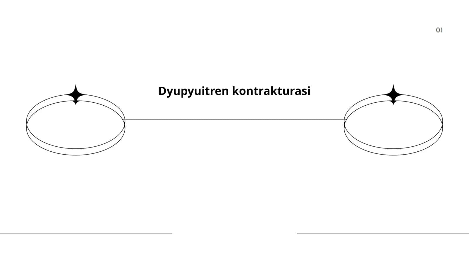 Dyupyuitren kontrakturasi