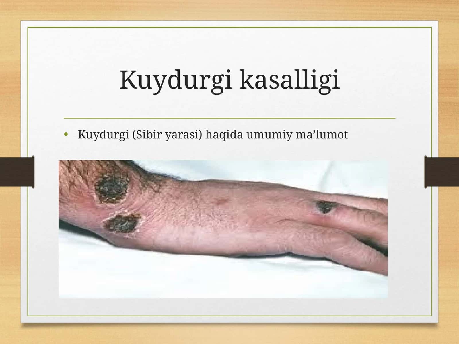 Kuydurgi kasalligi