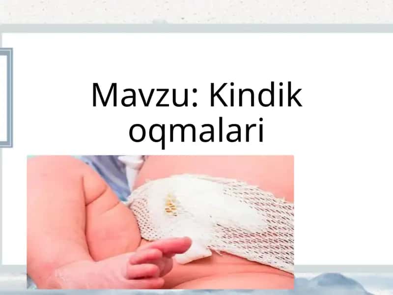 Kindik oqmalari