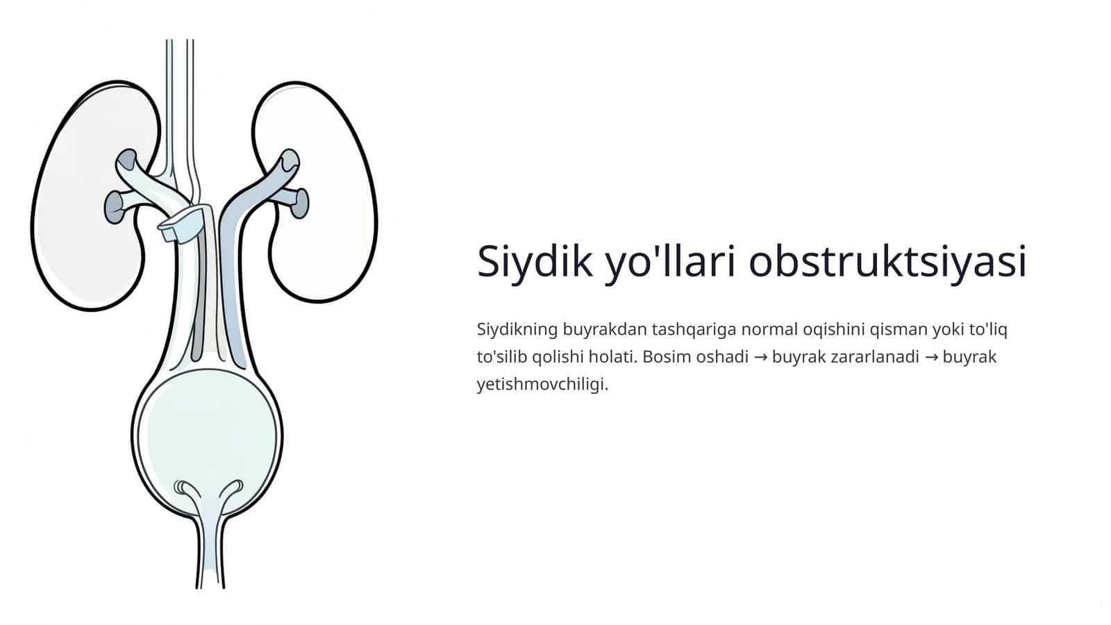 Siydik yo'llari obstruktsiyasi