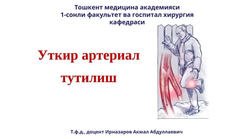 Уткир артериал тутилиш