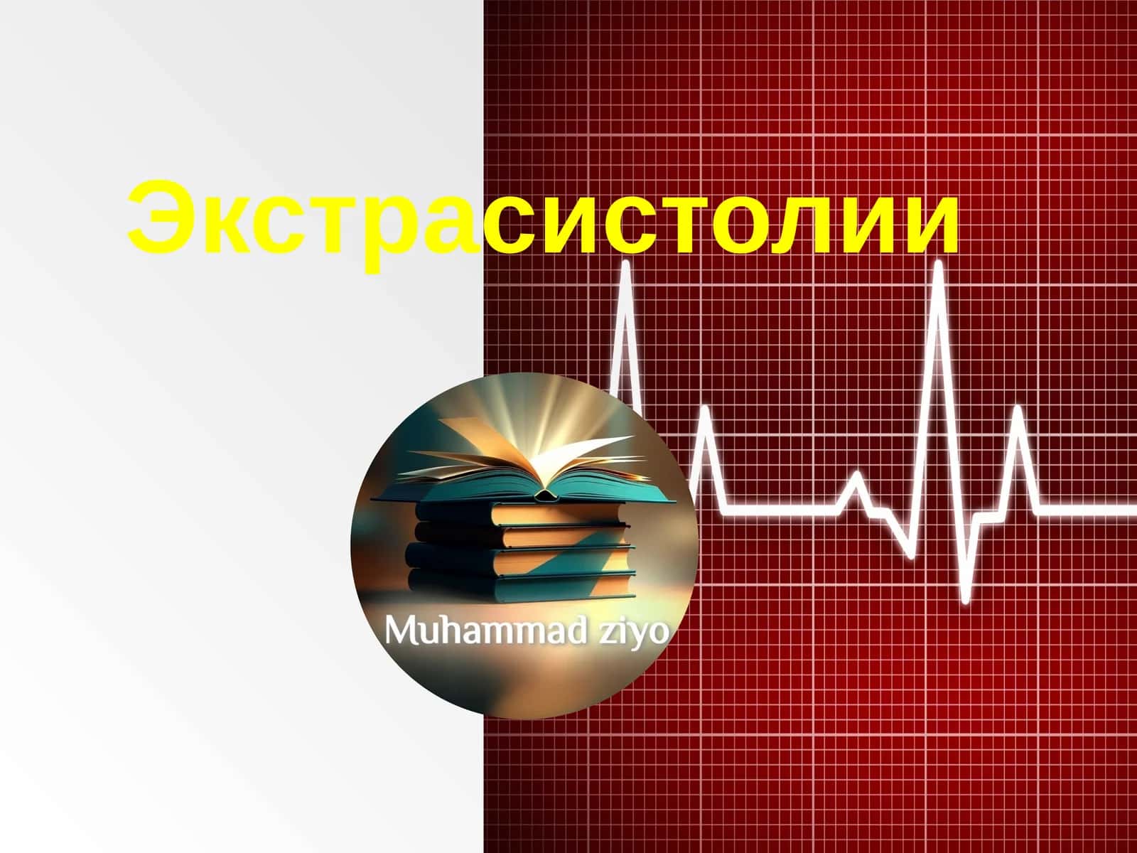 Экстрасистолии