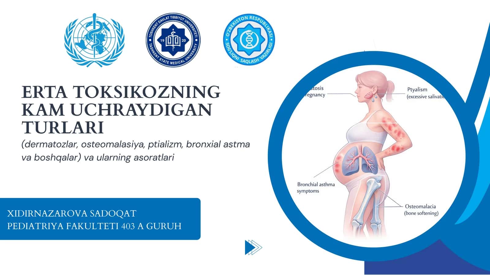 ERTA TOKSIKOZNING KAM UCHRAYDIGAN TURLARI
