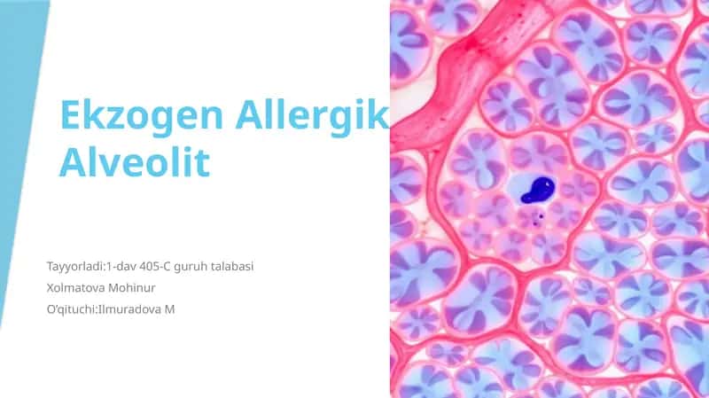 EkzogenAllergikAlveolit