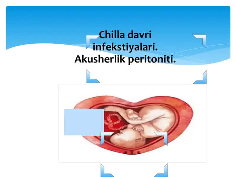 Chilla davri infekstiyalari. Akusherlik