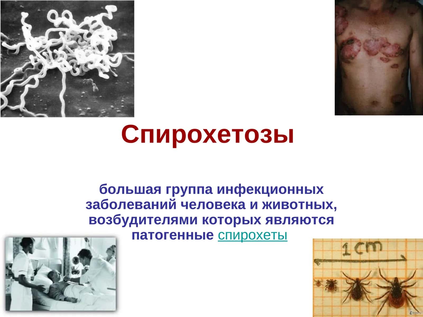 Спирохетозы