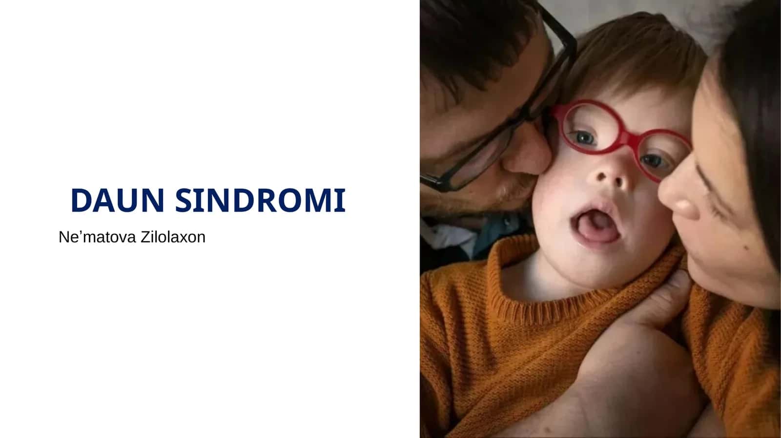 DAUN SINDROMI