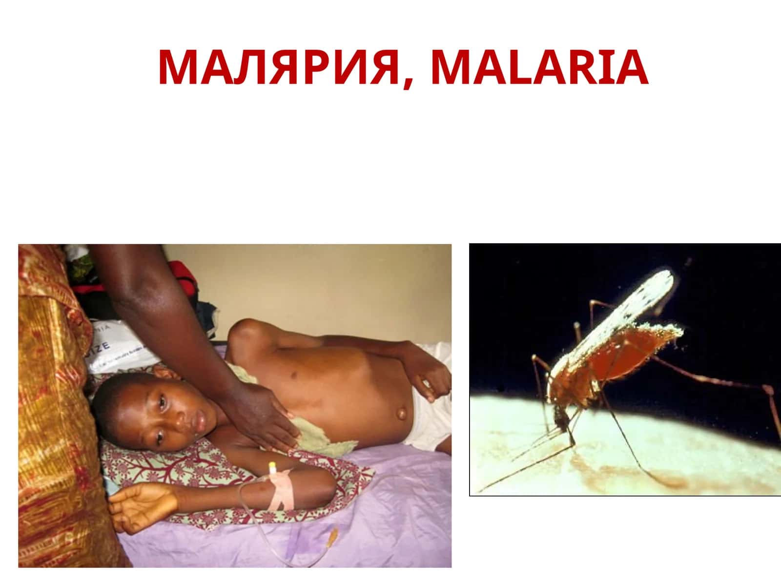 МАЛЯРИЯ