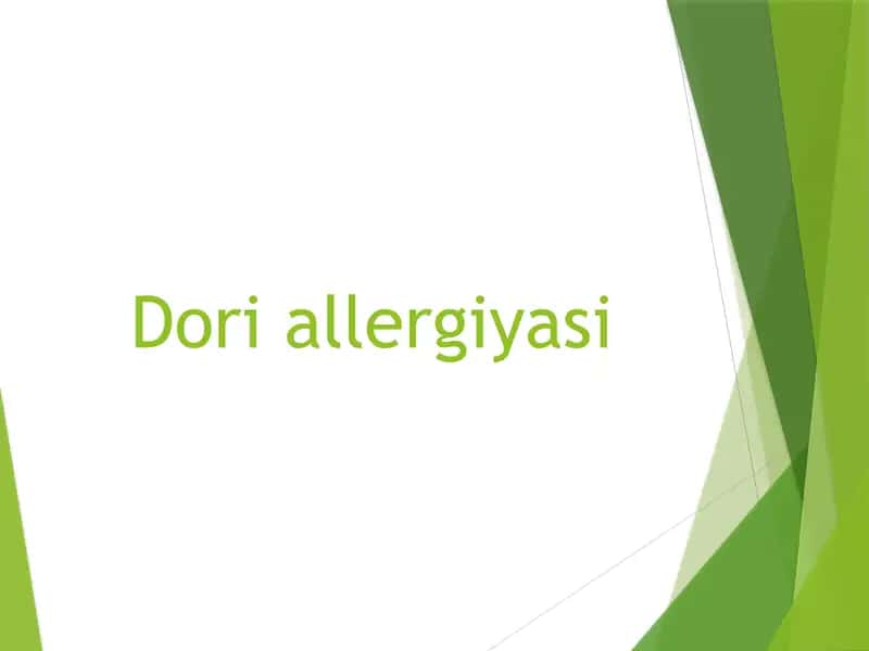 Dori allergiyasi