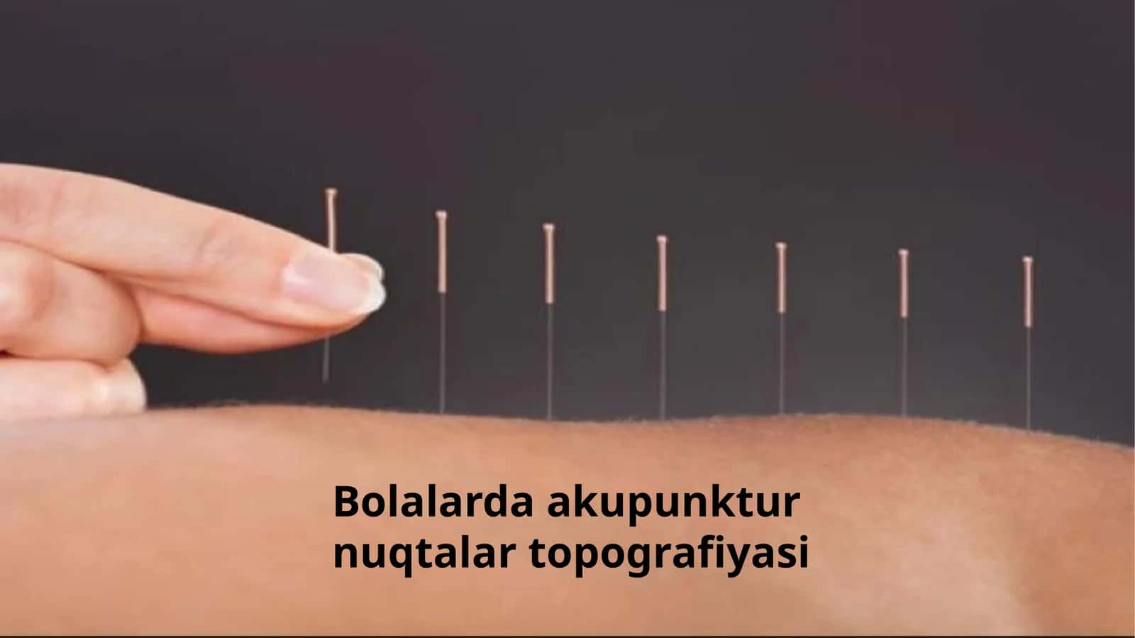 Bolalarda acupuncture nuqtalar topografiyasi