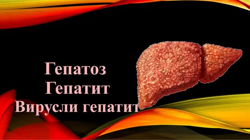 ГепатозГепатитВирусли гепатит