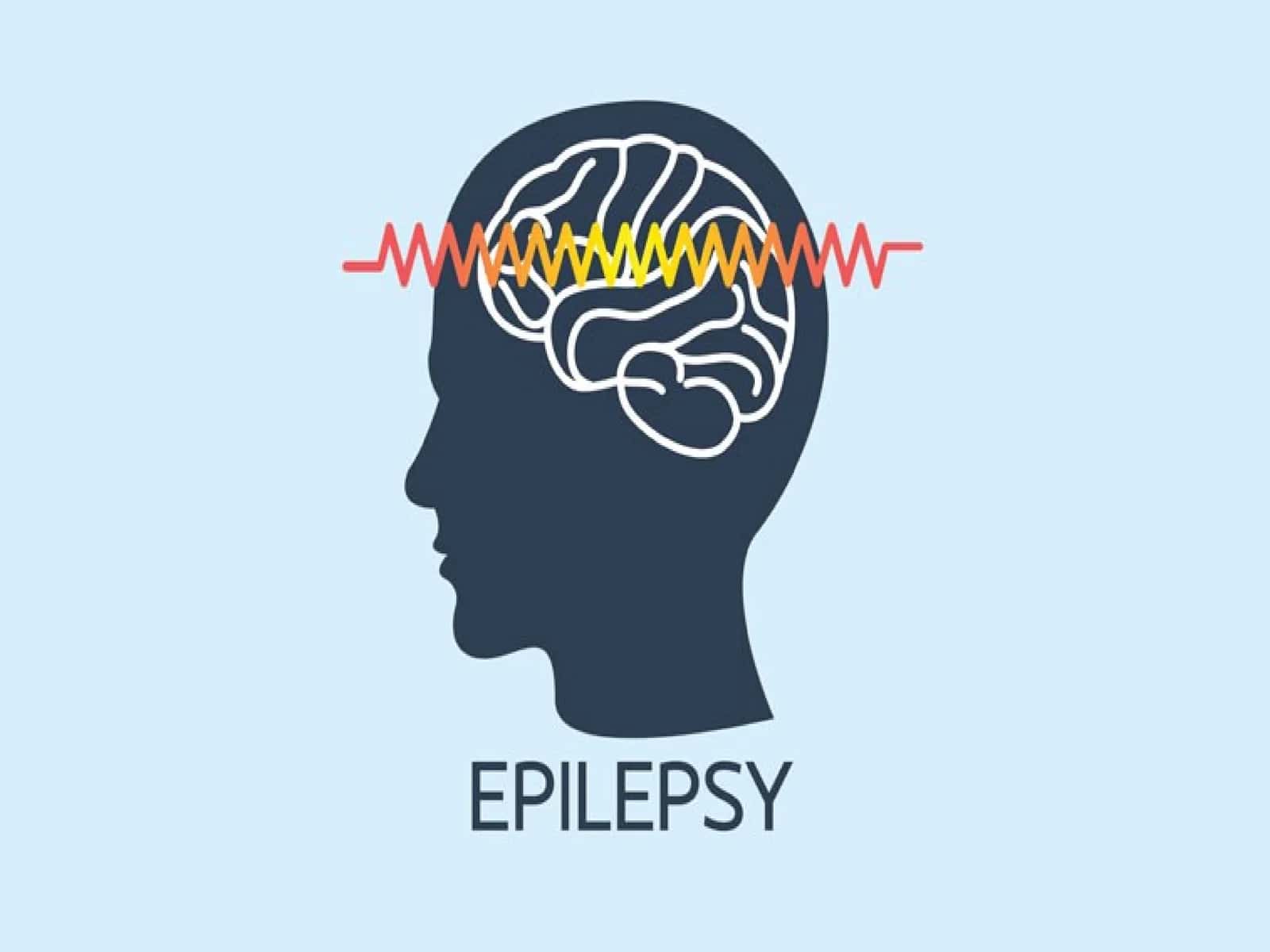 Epilepsiya