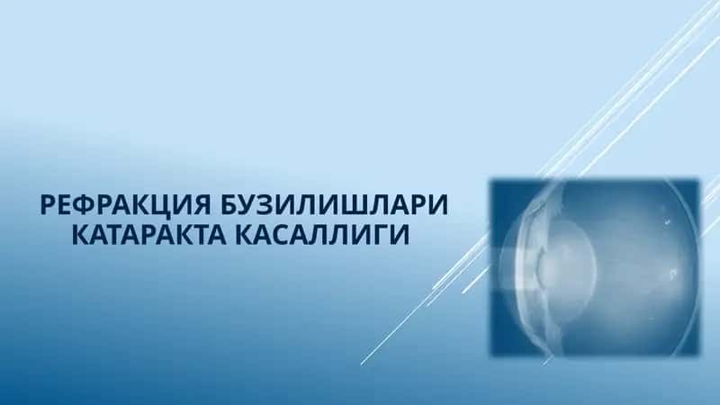 Рефракция бузилишлари катаракта касаллиги