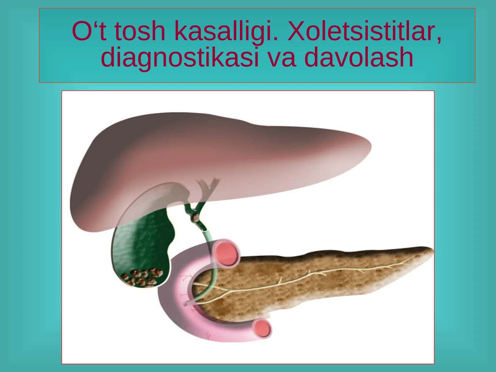 O't tosh kasalliklari, xolisistitlar diagnostikasi ppt