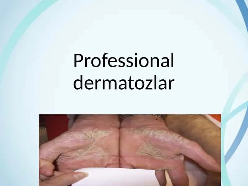 Professional dermatozlar