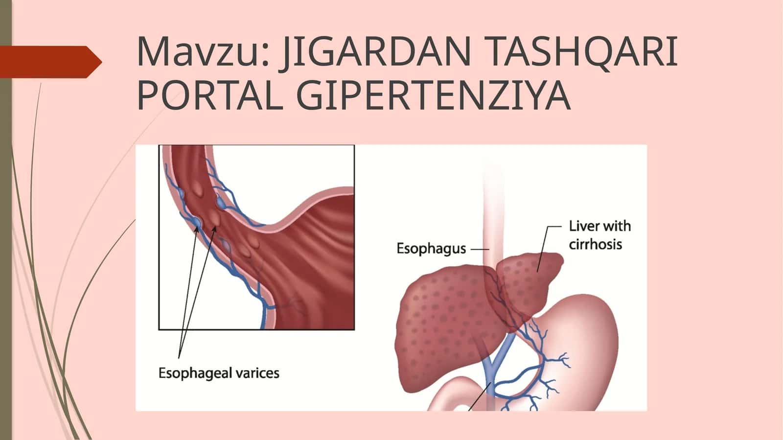 JIGARDAN TASHQARI PORTAL GIPERTENZIYA