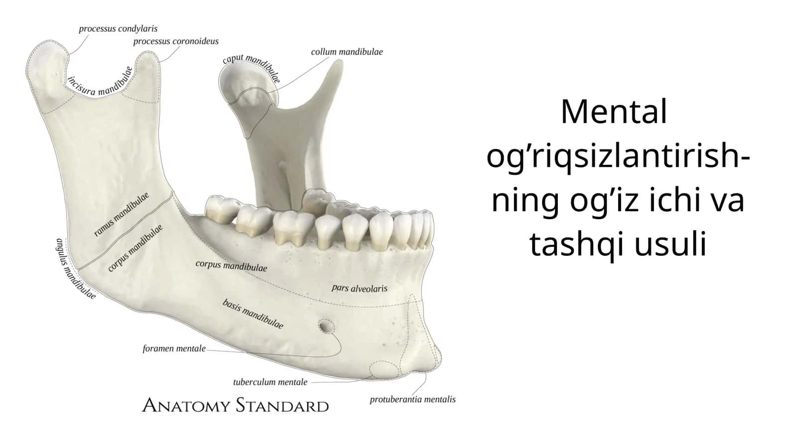 Mental og’riqsizlantirish-ningog’izichiva tashqiusuli