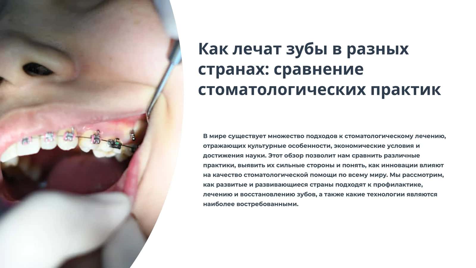 Как лечат зубы в разных странах: сравнение стоматологических практик