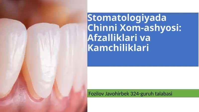 Chinni Xom-ashyosi