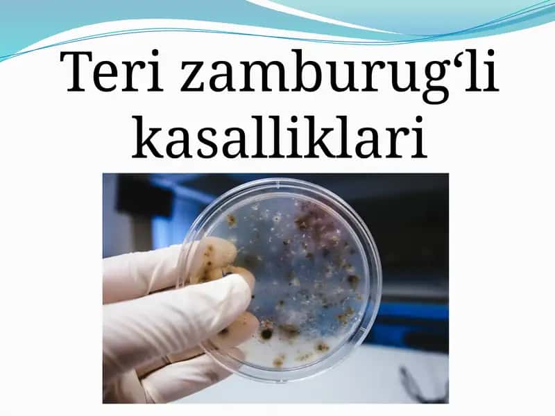 Terining zamburug‘li kasalliklari