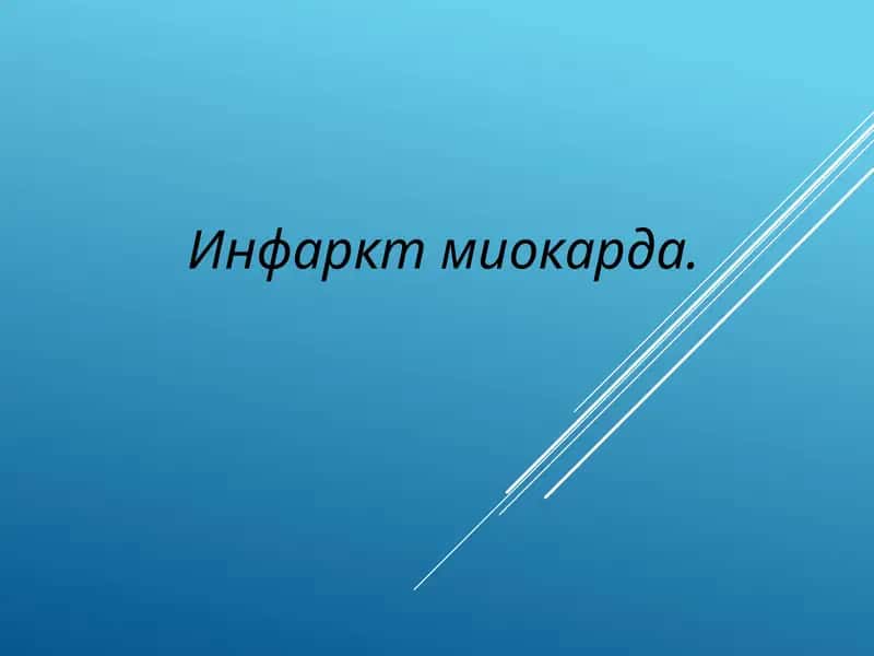 Инфаркт миокарда