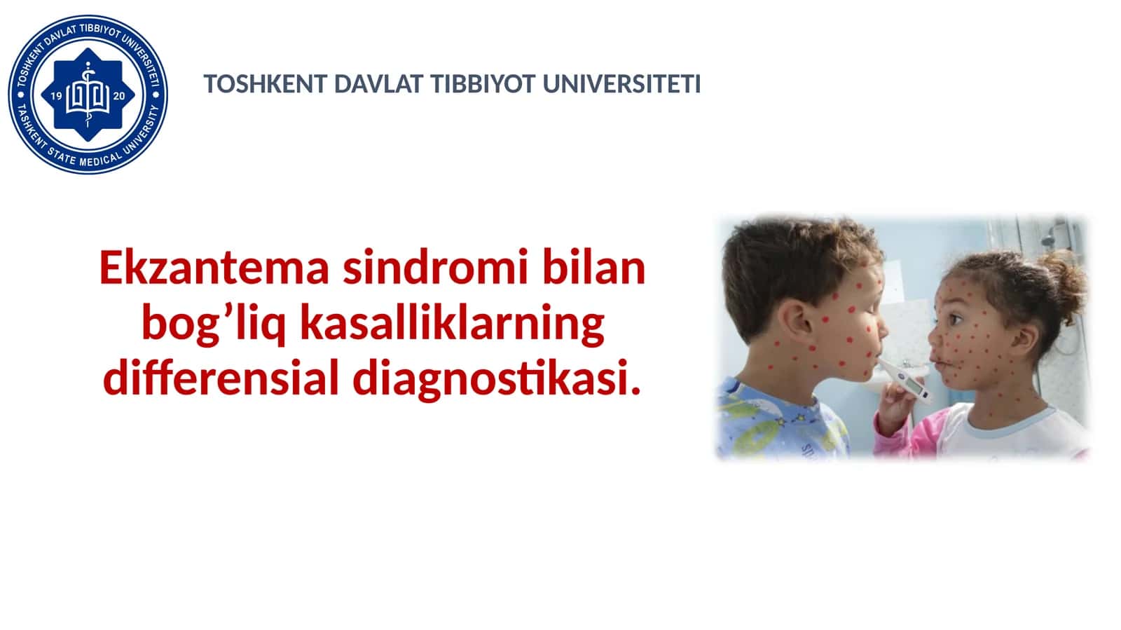 Ekzantema sindromi bilan bog’liq kasalliklarning differensial diagnostikasi