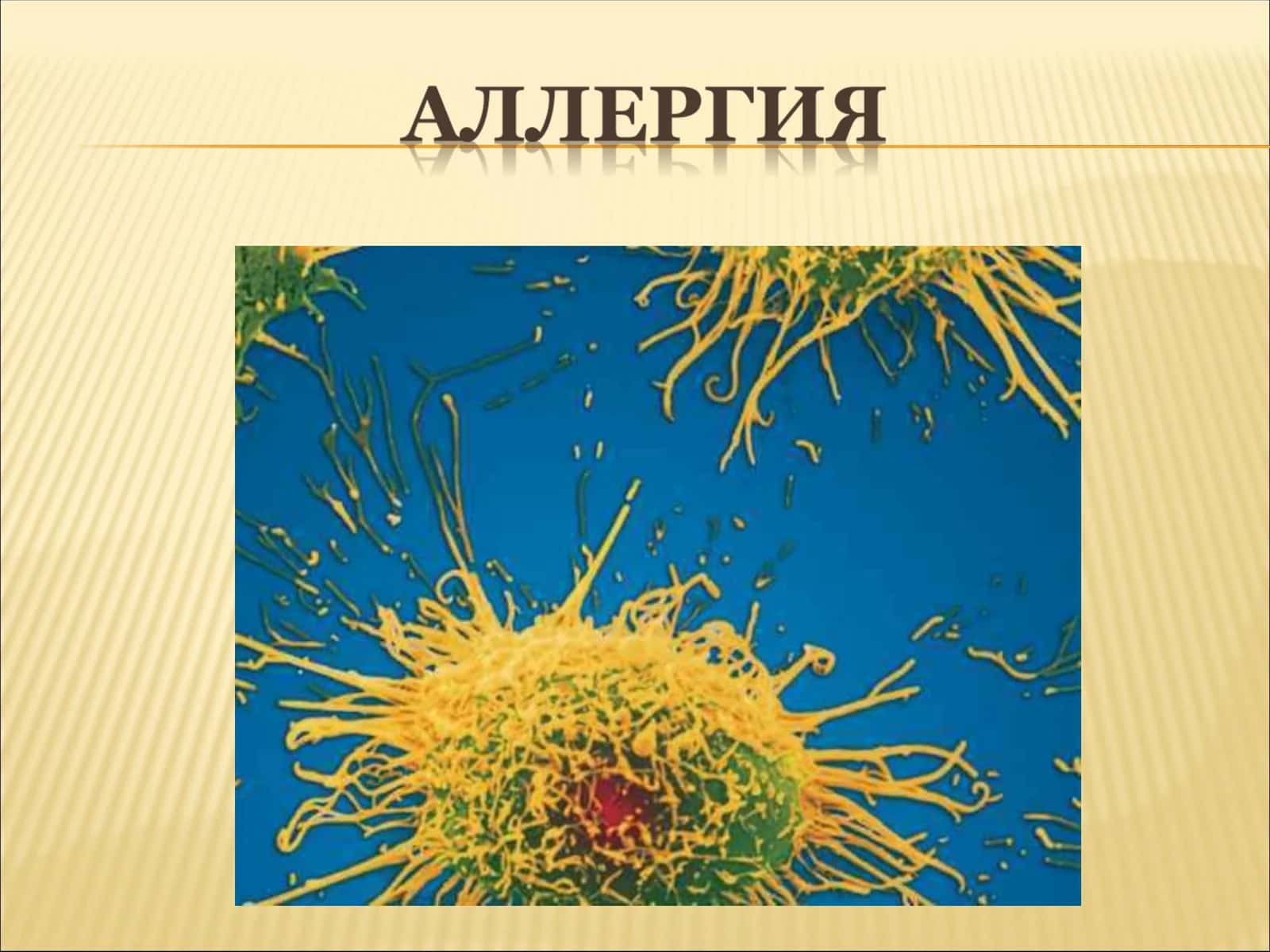 Аллергия