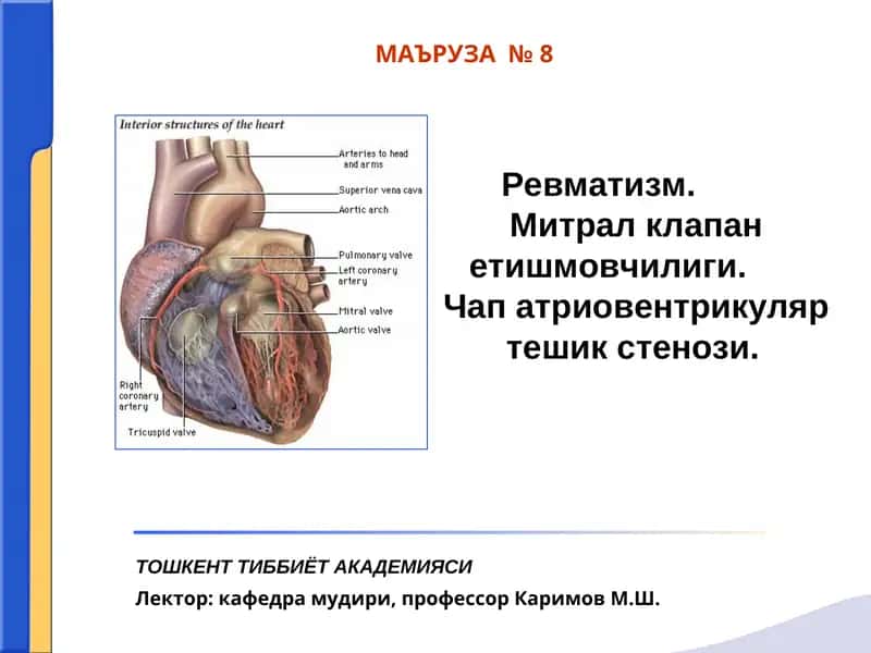 Ревматизм