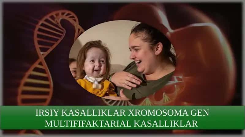 Irsiy kasalliklar; xromosomalar