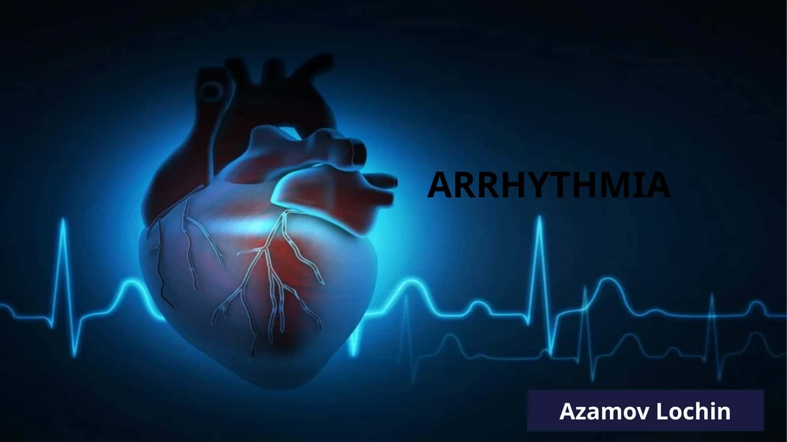 Supraventricular arrhythmia