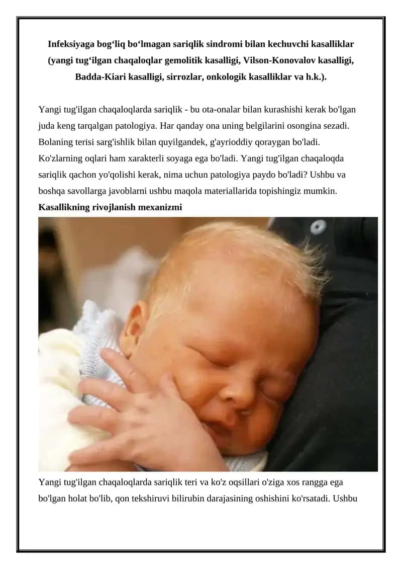 Yangi tug‘ilgan chaqaloqlarda sariqlik