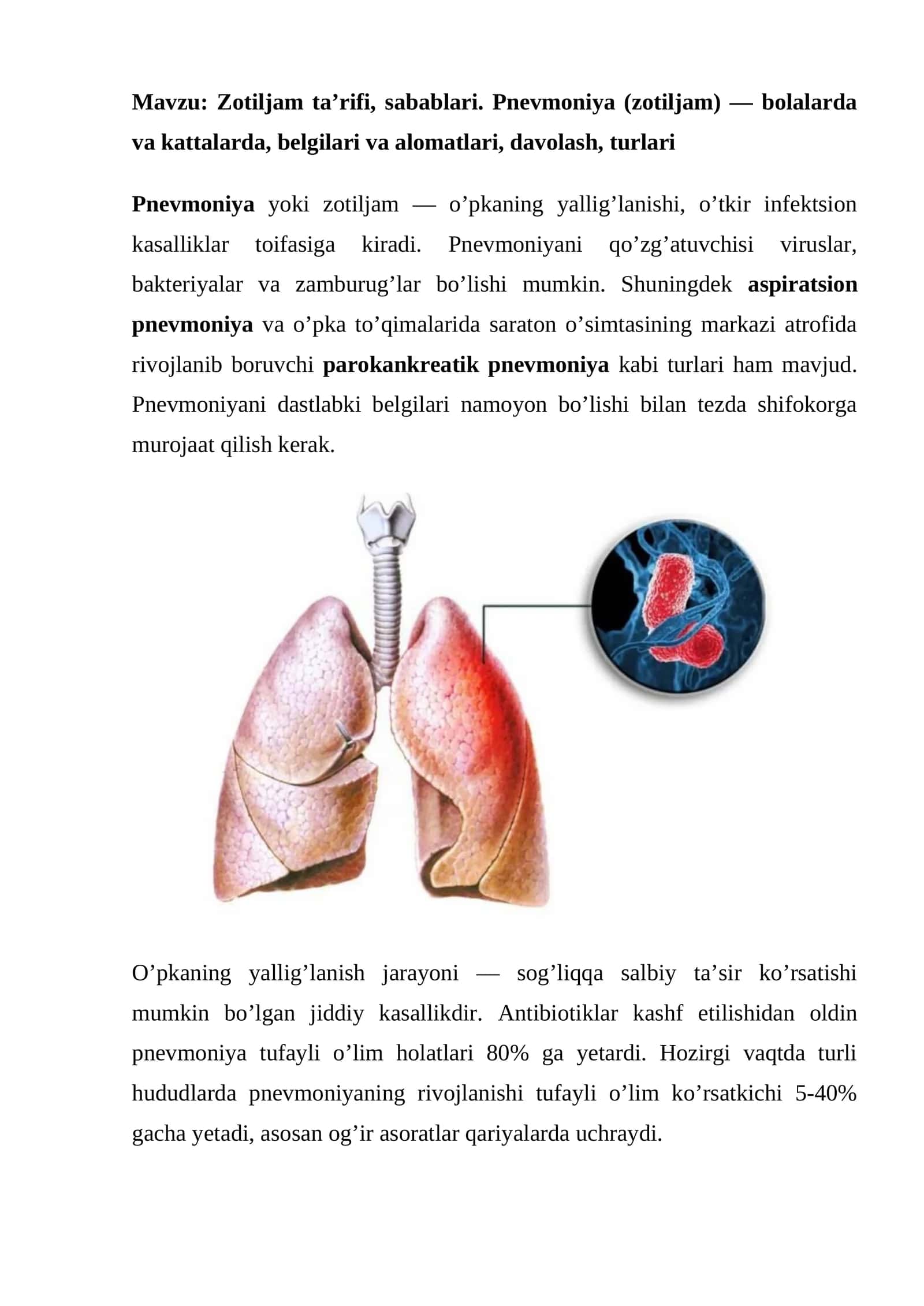 Zotiljam ta’rifi, sabablari. Pnevmoniya (zotiljam) - bolalarda va kattalarda, belgilari va alomatlari, davolash, turlari