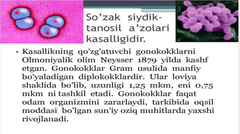 Soʻzak
