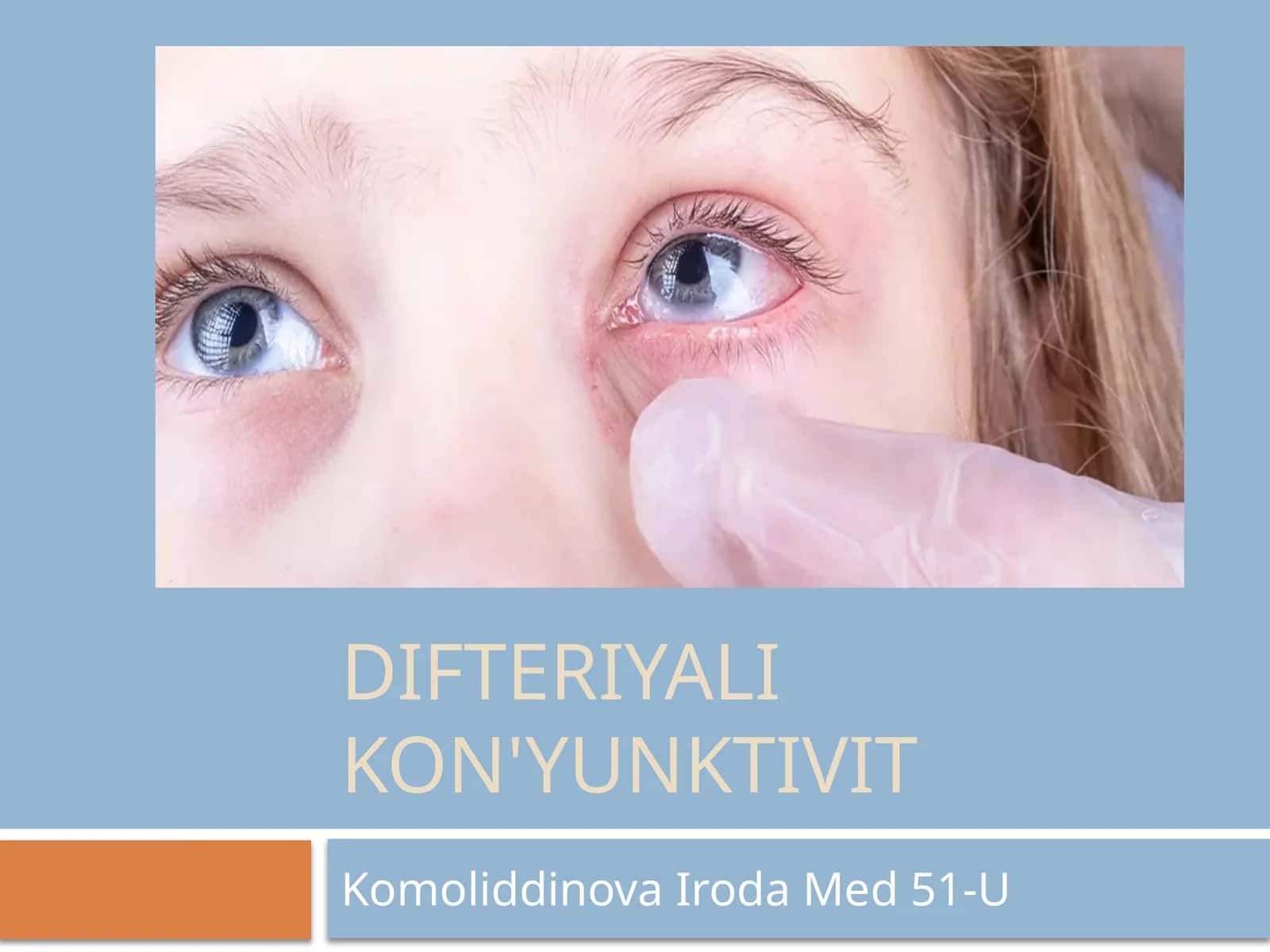 Difteriyali kon'yunktivit