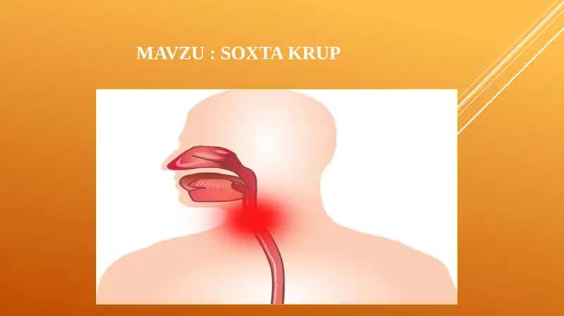 Soxta   krup