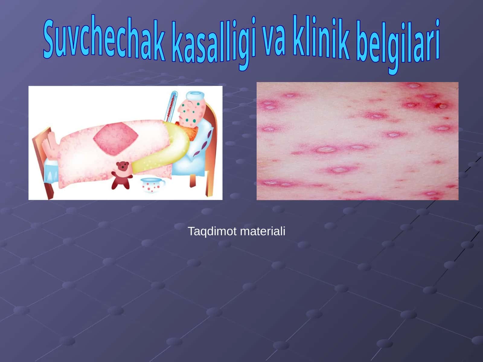 Suvchechak kasalligi va klinik belgilari