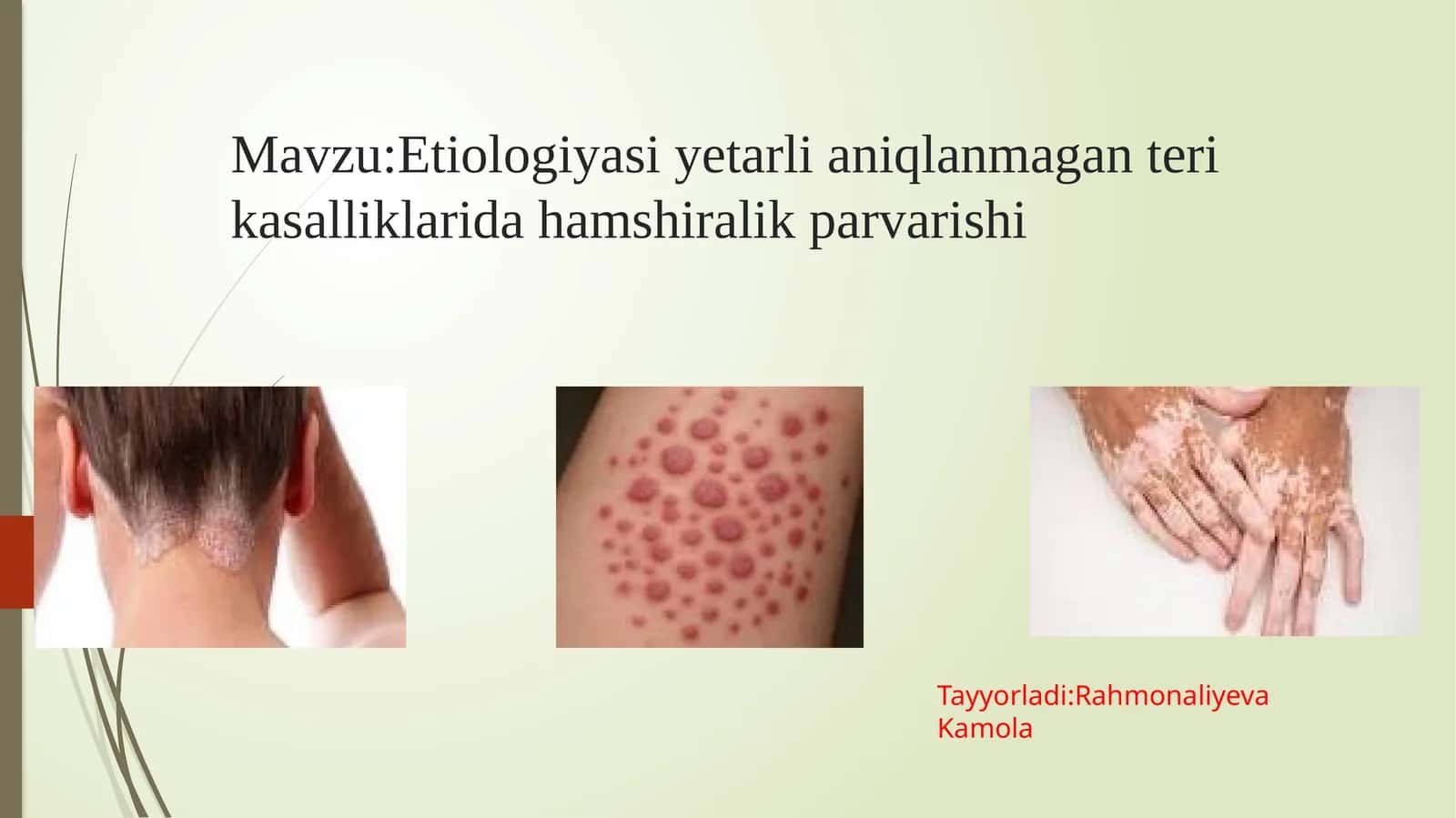 Etiologiyasi yetarli aniqlanmagan teri kasalliklarida hamshiralik parvarishi