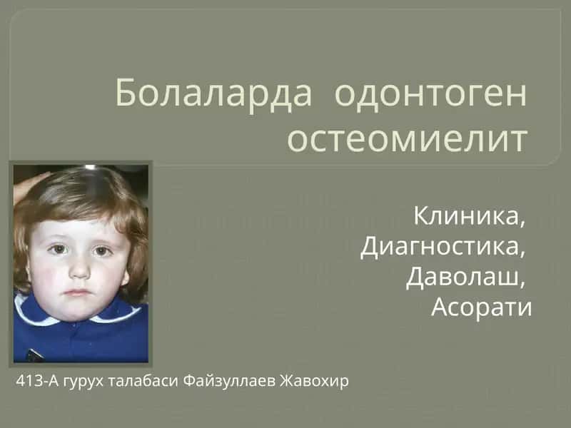 Болаларда одонтоген остеомиелит
