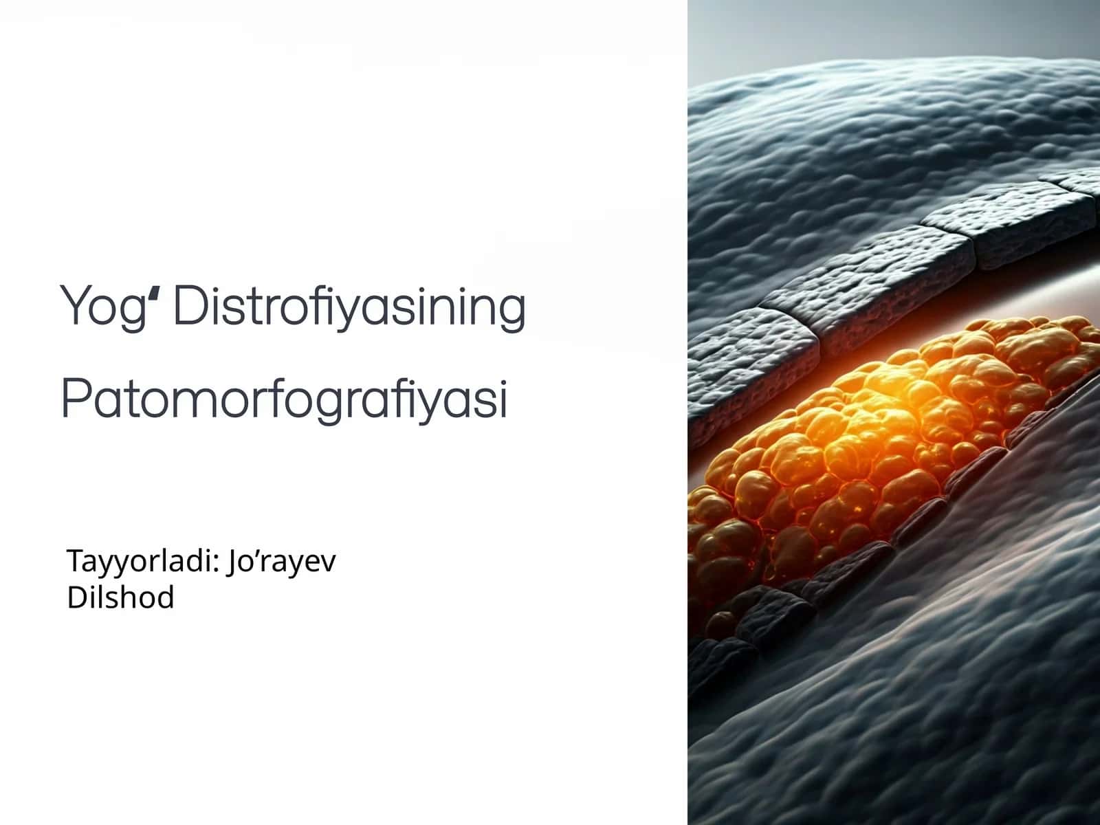 Yogʻ Distrofiyasining Patomorfografiyasi