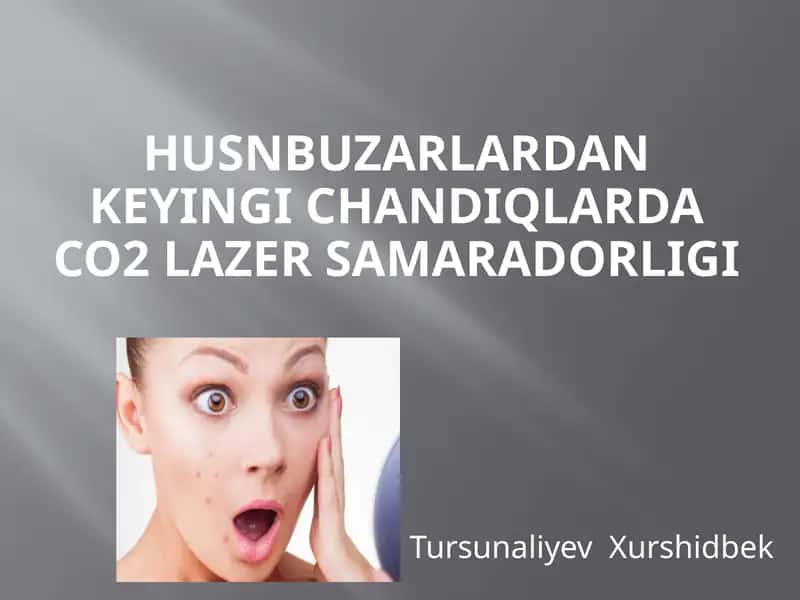 Husnbuzarlar