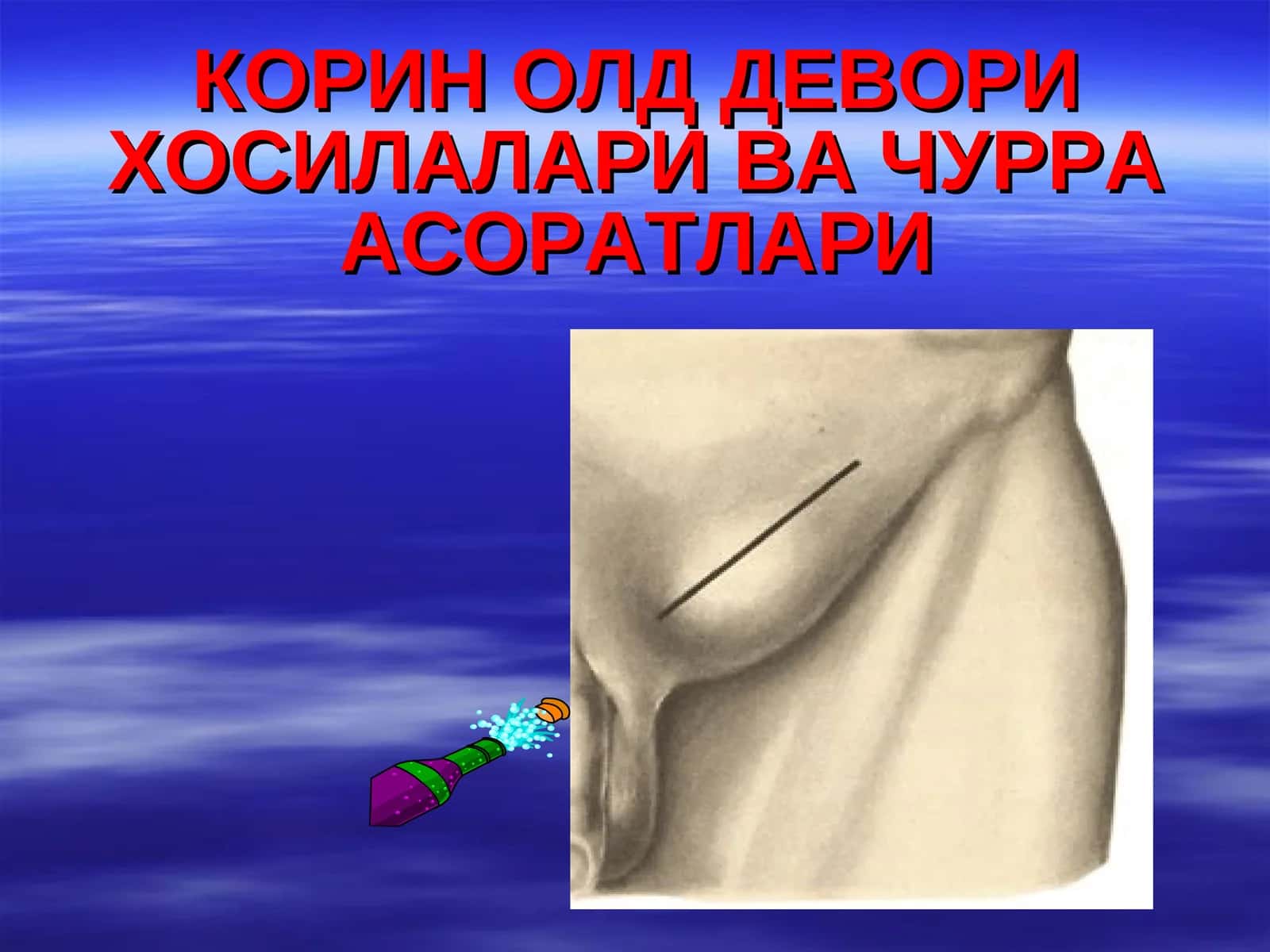 КОРИН ОЛД ДЕВОРИ ХОСИЛАЛАРИ ВА ЧУРРА АСОРАТЛАРИ
