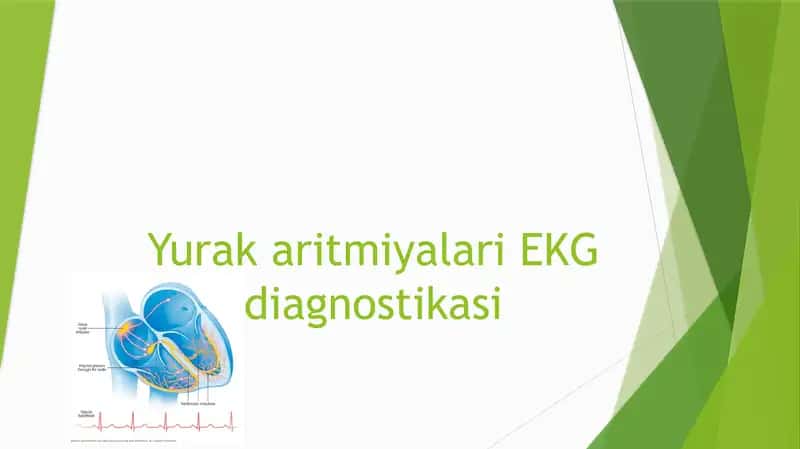 Yurak aritmiyalari EKG diagnostikasi