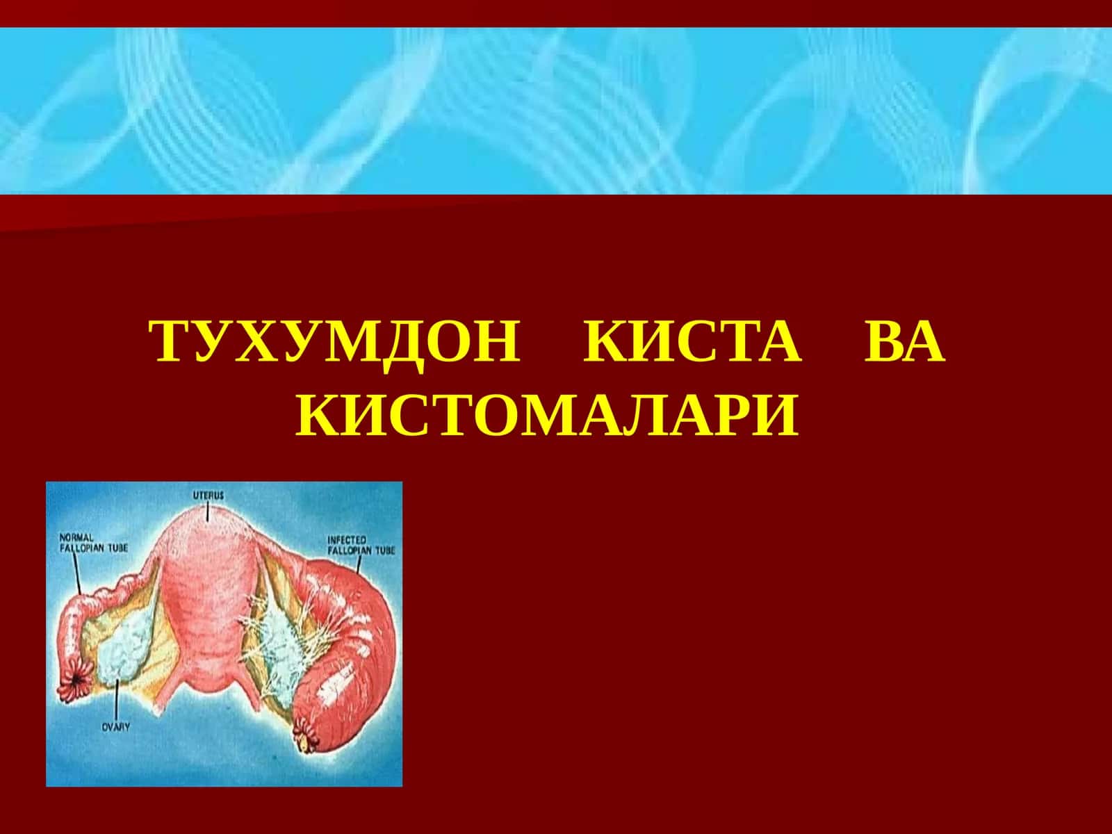 ТУХУМДОН КИСТА ВА КИСТОМАЛАРИ