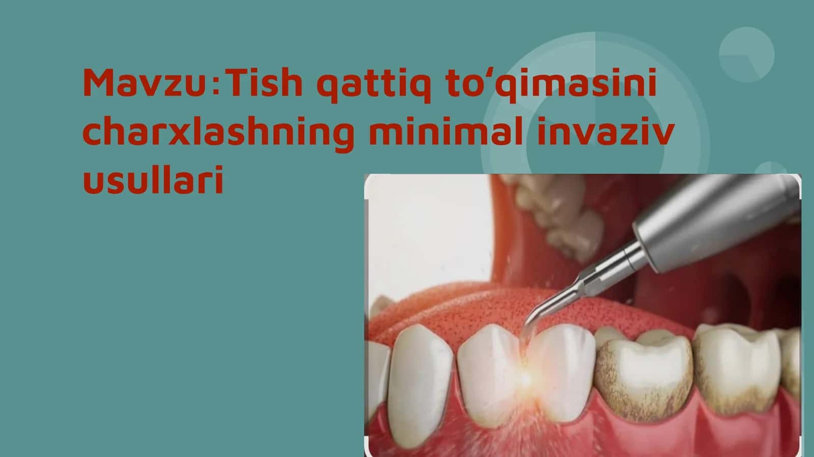 Tish qattiq toʻqimasini charxlashning minimal invaziv usullari