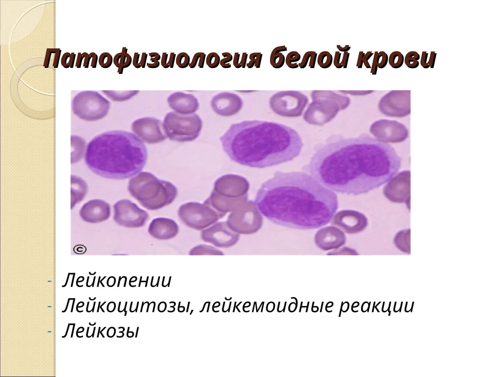 Патологическая лейкопения