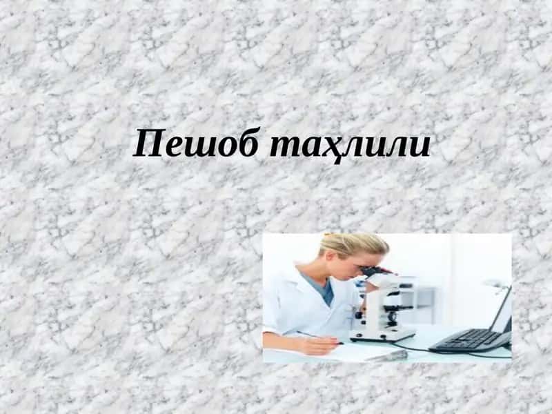 Peshob tahlili | Умумий сийдик таҳлили